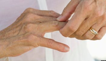 Remedios naturales contra la artritis
