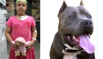 Niña dominicana sobrevive al fiero ataque de un Pit Bull en edificio del Alto Manhattan 