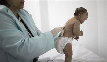 ¿Pueden los científicos vincular el zika y la microcefalia?