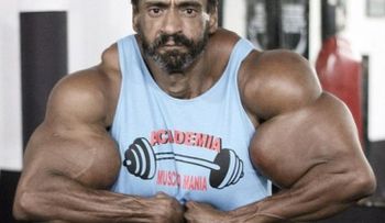 El hombre que se inyecta aceite en los bíceps para parecerse a Hulk 