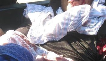 Un hombre recibe varios machetazos, tras reclamarle a otro por el robo de víveres 