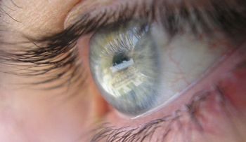 Identifican el gen de los ojos azules, las pecas y el pelo claro