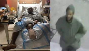 Dominicano acusado de empujar compatriota a vías del tren pierde parte de una pierna