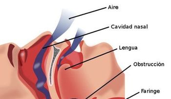Siete tips para dejar de roncar