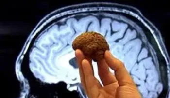 ¿Qué efectos causa en el cerebro comer cacao o chocolate?