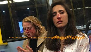 Una azafata uruguaya y su novia recibieron una terrible golpiza, porque se negaron a besarse