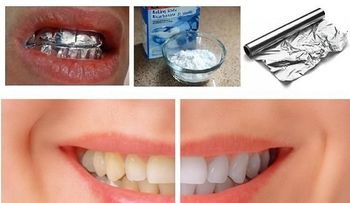  Mira qué pasa cuando envuelves tus dientes con papel de aluminio