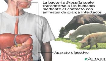 Brucelosis humana, canina y bovina: tratamiento, síntomas, causas