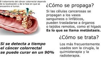 El Dr. José Ramírez explica qué es y cómo tratar el cáncer