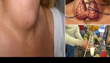 Tiroides feliz: El secreto que tu médico no te dirá