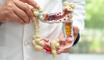 Crohn y colitis ulcerosa: enfermedades crónicas que inflaman el intestino