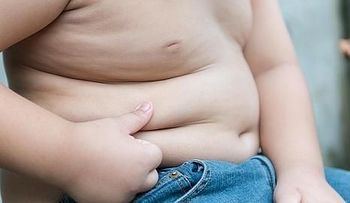  Obesidad mórbida en adolescentes acorta hasta 40 años la esperanza de vida 