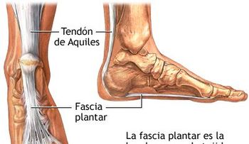 Enfermedad de la fascitis plantar; síntomas y tratamientos (VIDEO)