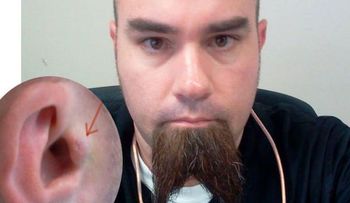 Se implanta auriculares en los oídos para escuchar música