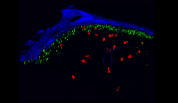 El VIH moviéndose por el cuerpo en tiempo real (VIDEO)
