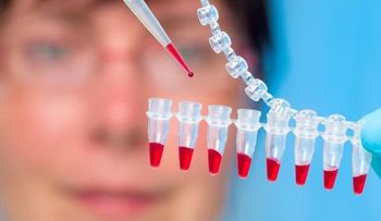 Unos ansiolíticos podrían vincularse con el riesgo de Alzheimer.
