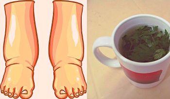 ¡Este es, quizás, el más poderoso remedio natural para aliviar la hinchazón de los pies!