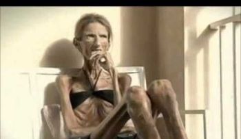 DIOS MIO, nunca intente adelgazar de esta forma: mira el mal estado de esta mujer famosa (VIDEO)