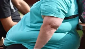 Sobrepeso y obesidad alcanzan proporciones "epidémicas" en Europa, alerta OMS