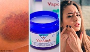El VICKS VAPORUB y sus increíbles usos hasta en la vida sexual. Ver enlace del video