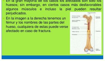 ¿Sabías que cada 3 segundos ocurre una fractura osteoporótica?