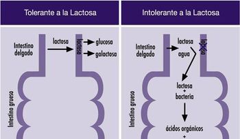  Señales de intolerancia hacia la lactosa 
