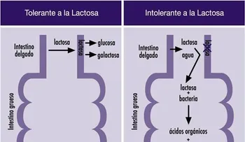  Señales de intolerancia hacia la lactosa 