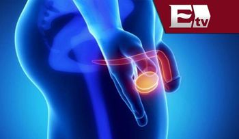 Cáncer de próstata: Síntomas y Factores de riesgo