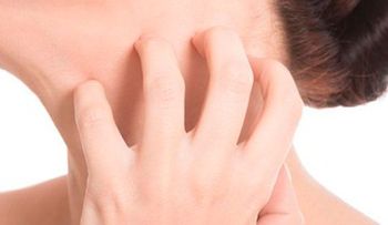6 razones para no rascarte si tienes mucha comezón