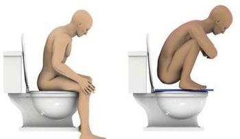 ¿Vas correctamente al baño? Conoce la postura para sentarse