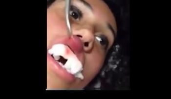 Fue al médico por una hinchazón en el labio...y le sacan algo increíble (VIDEO)