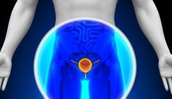 Si siente uno de estos síntomas podría estar sufriendo de cáncer de vejiga