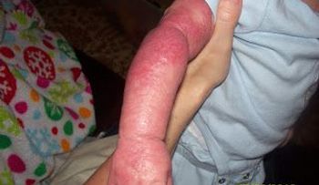 Una madre encuentra la cura a la enfermedad de su hijo en Internet