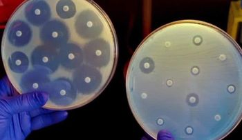 La superbacteria resistente a los antibióticos que preocupa a Estados Unidos