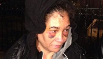 Presunto violador propina golpiza a dominicana