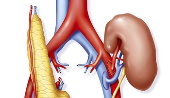 La historia de Manuel: dos trasplantes de riñón, un cáncer testicular y un linfoma: