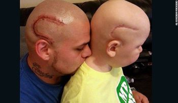 Niño con tumor cerebral ayuda a su padre a lidiar con el dolor