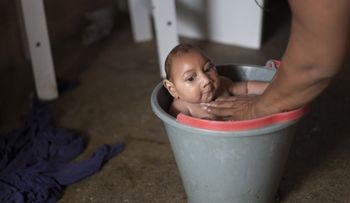 Mueren en Brasil 5 bebés con malformación causada por el zika