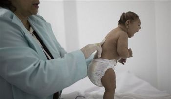 Zika podría causar más deficiencias además de microcefalia