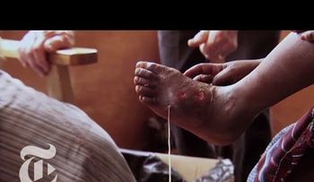 4 parásitos humanos que no querrás tener (VIDEO)