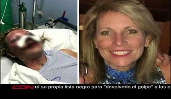 Presidente DM ordena investigar caso de turista golpeada; PN dice hay incongruencias entre mujer y su esposo