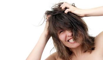 ¿Tenés caspa? Consejos fáciles para prevenirla