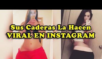 Sufre de una rara enfermedad llamada Linfedema, que le hace tener las caderas más grandes del mundo (VIDEO)
