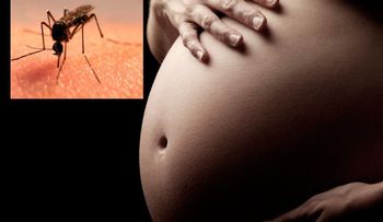Primer caso de zika en una mujer embarazada en Singapur