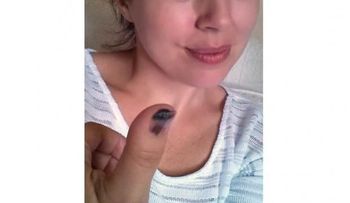 ¿Ven eso en mi pulgar? Es cáncer de piel