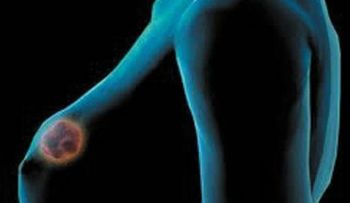Inventan unas gafas que pueden 'ver' el cáncer
