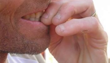 Comerse las uñas tiene riesgos mortales; un hombre casi se muere por hacerlo