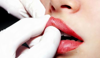 ¿El Botox es la nueva panacea? Los increíbles usos posibles de la droga