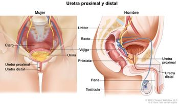Urólogos preocupados por aumento cáncer de vejiga