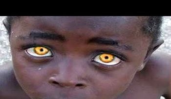 Estas son las 10 personas con color de ojos únicos en el MUNDO 